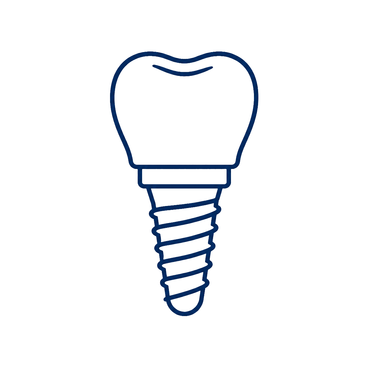 Dental Implants