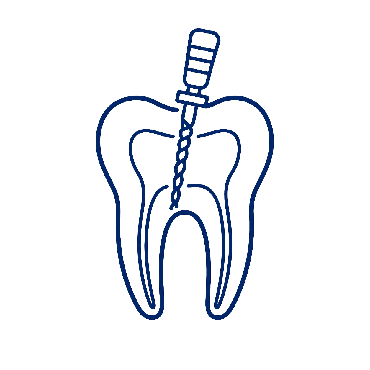Root Canal