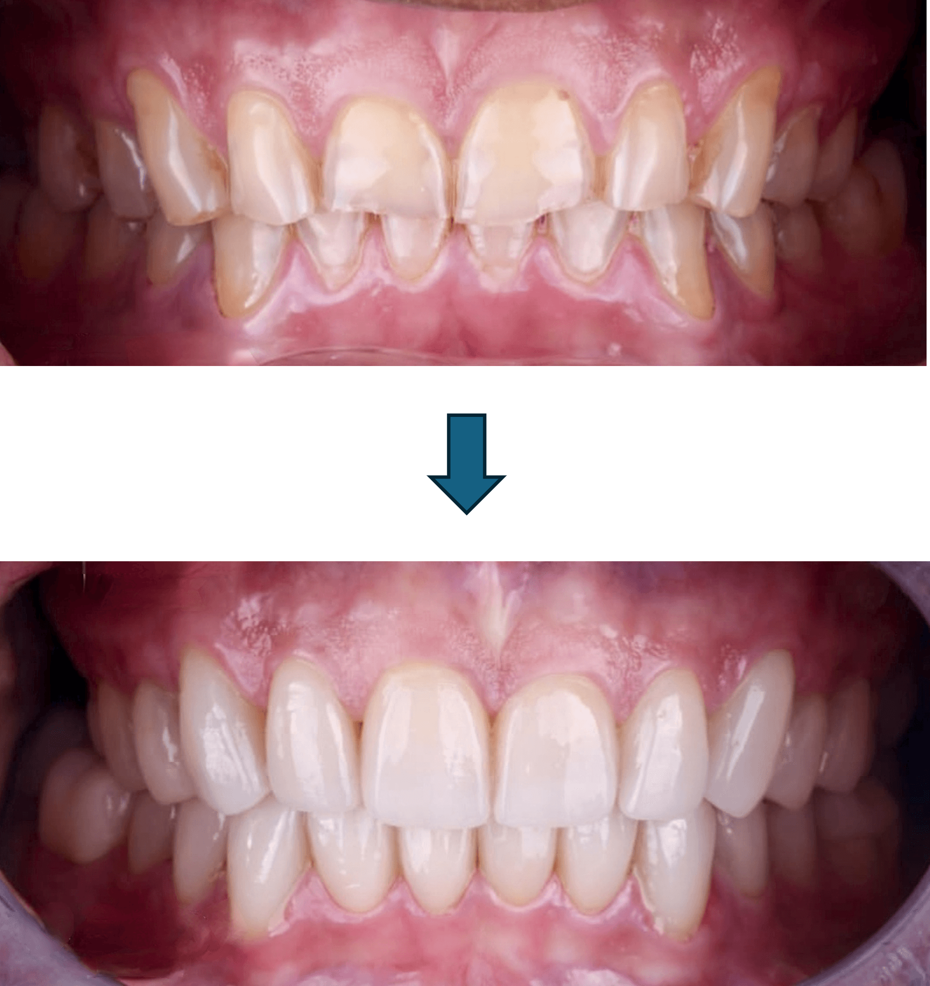 Smile Designing result 5