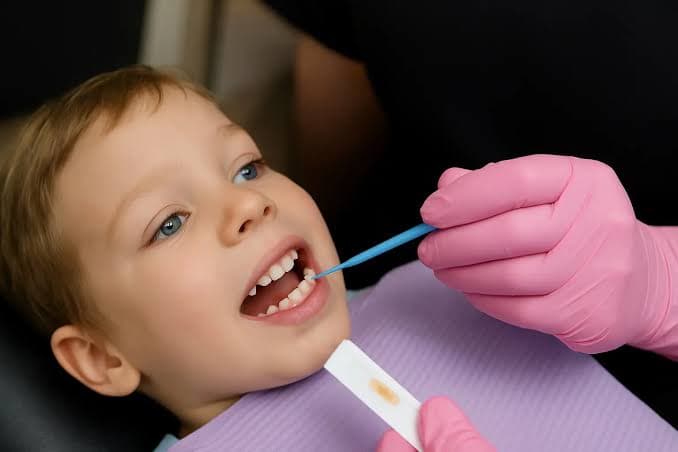 Fluoride Treatment image