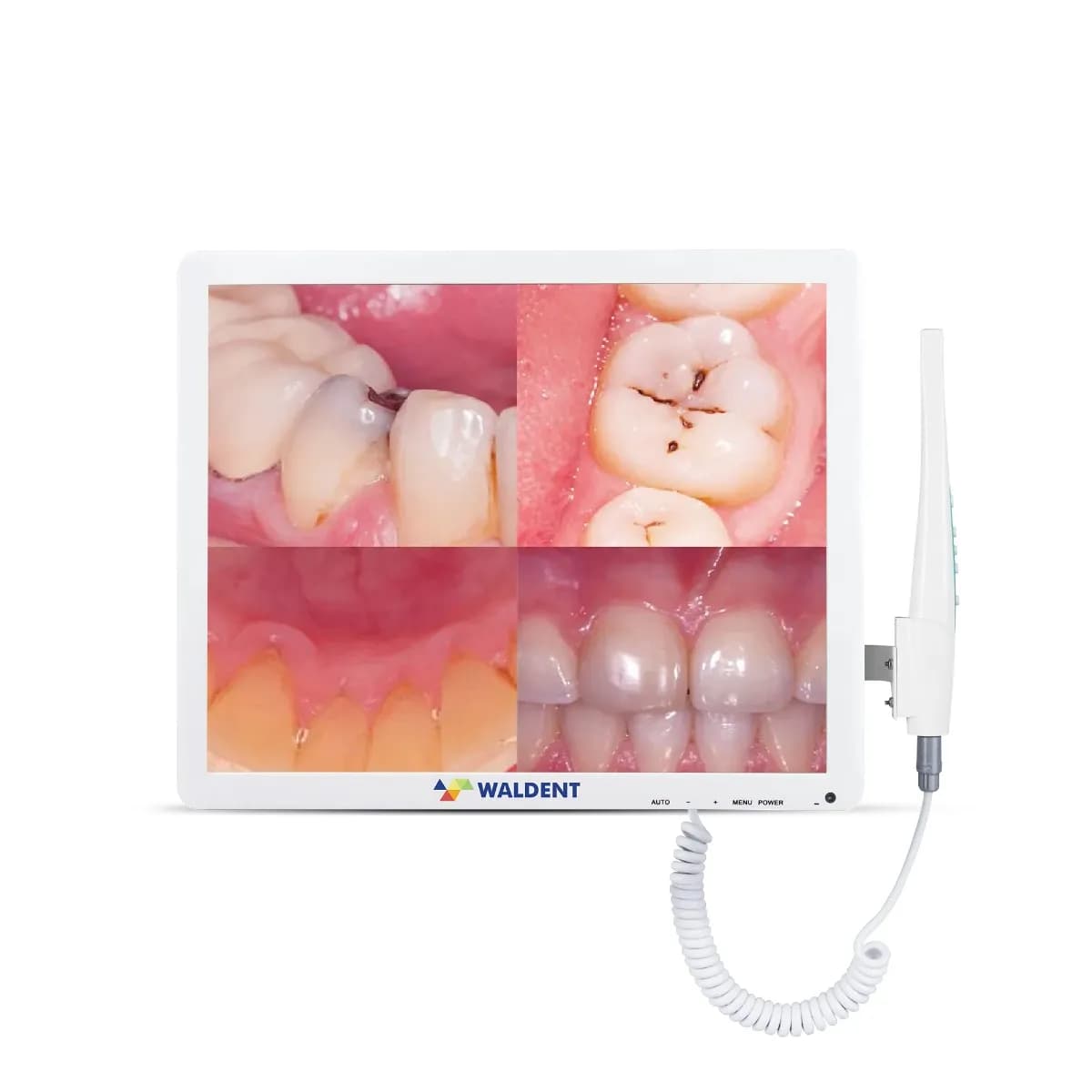 Intraoral Camera